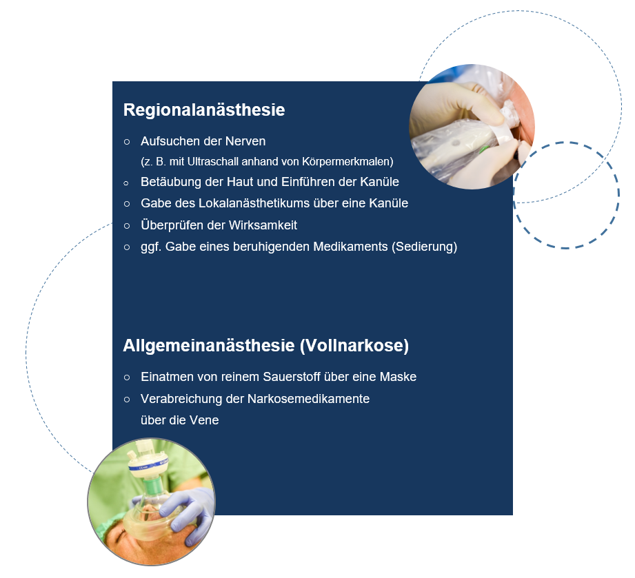 OPVorbereitung netra